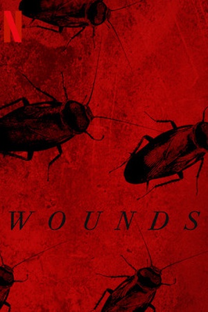 Wounds