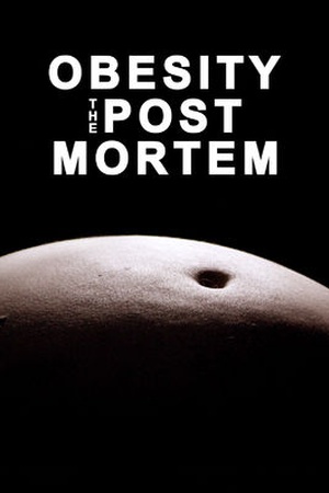 Obesity: The Post Mortem