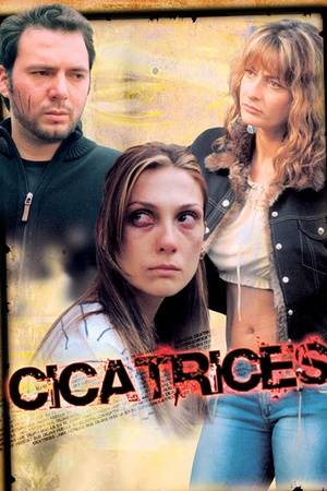 Cicatrices