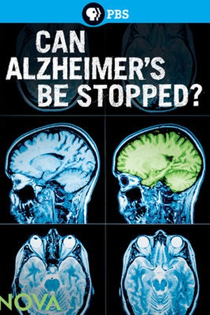 Can Alzheimer;s Be Stopped?