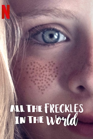 All the Freckles in the World